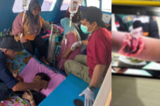 Cari Udang di Pulau Semut Maratua, Bocah 11 Tahun Diserang Hiu