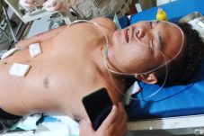 Diserang Buaya Saat Mandi di Sungai, Pemuda Teluk Bayur Nyaris Meregang Nyawa