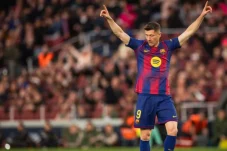 Lewandowsky Absen, Patah Tulang Rongga Mata Jelang Kontra Atletico Madrid?