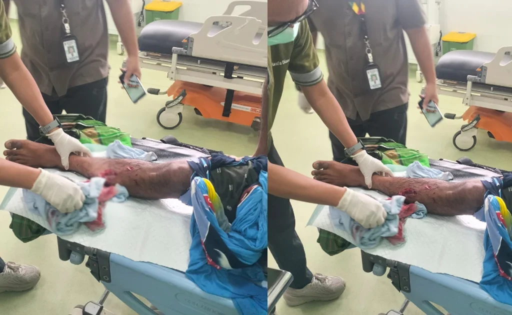 Warga Berau menjadi korban serangan buaya (Ist)