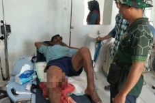 Buaya Berulah Lagi! Warga Tabalar Muara Alami Luka Gigitan di Kaki
