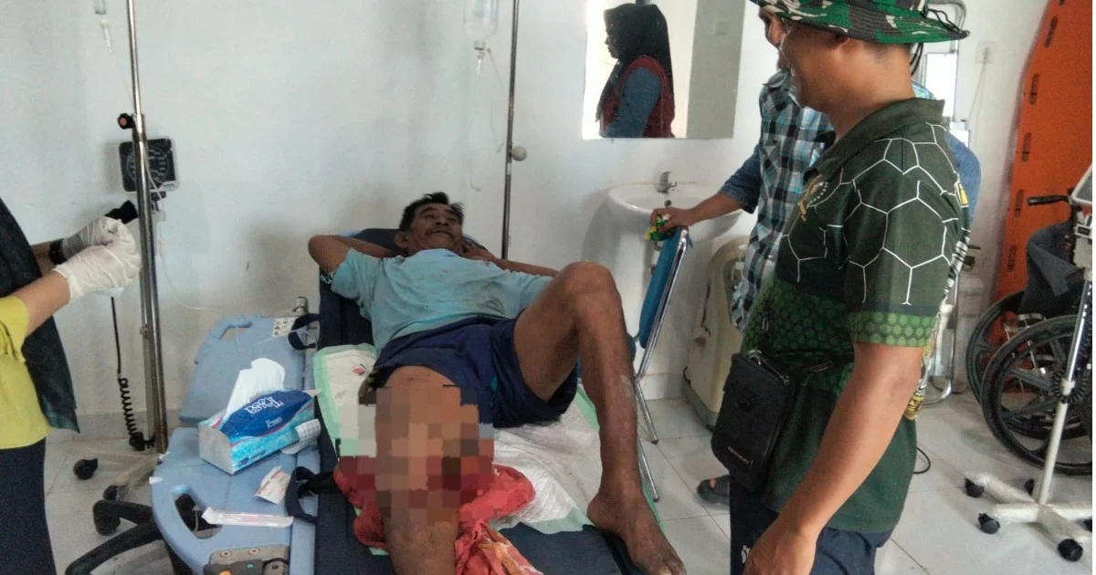 Buaya Berulah Lagi! Warga Tabalar Muara Alami Luka Gigitan di Kaki