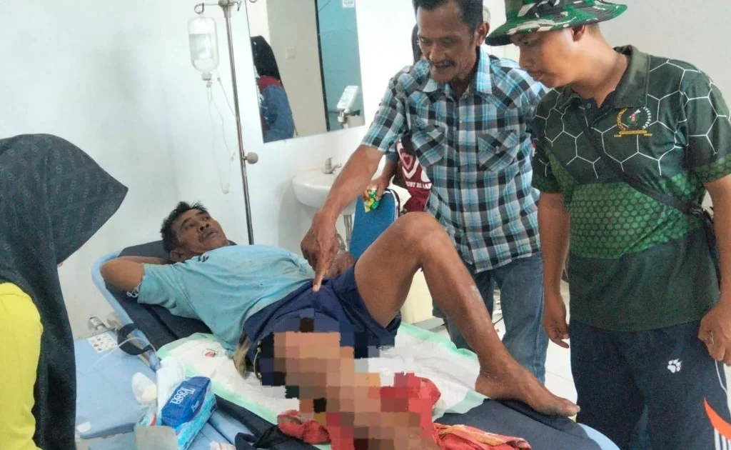 Korban gigitan buaya, Abdul Majid, mendapatkan perawatan intensif di puskesmas Tabalar Muara. (Ist)