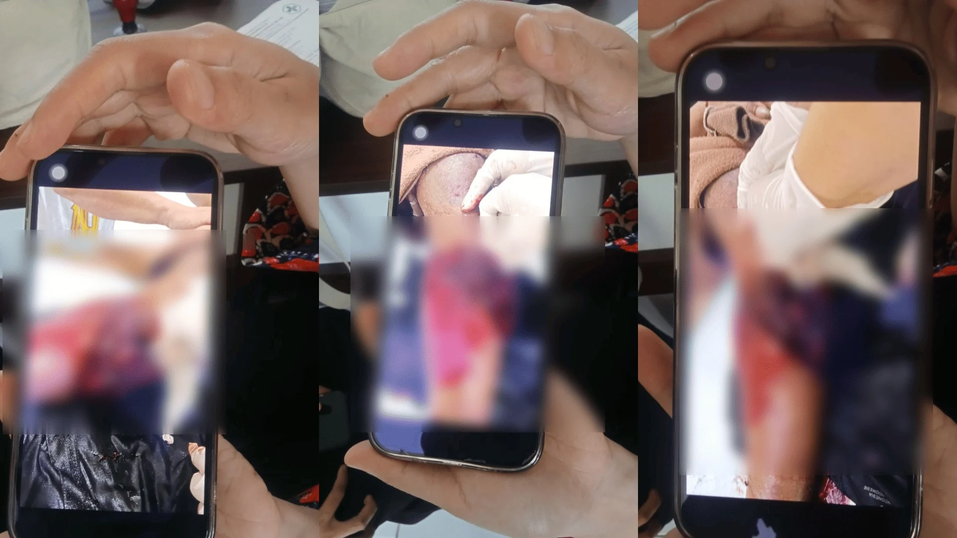 Diduga Diserang Buaya saat Memancing, Warga Segah Dilarikan ke Puskesmas